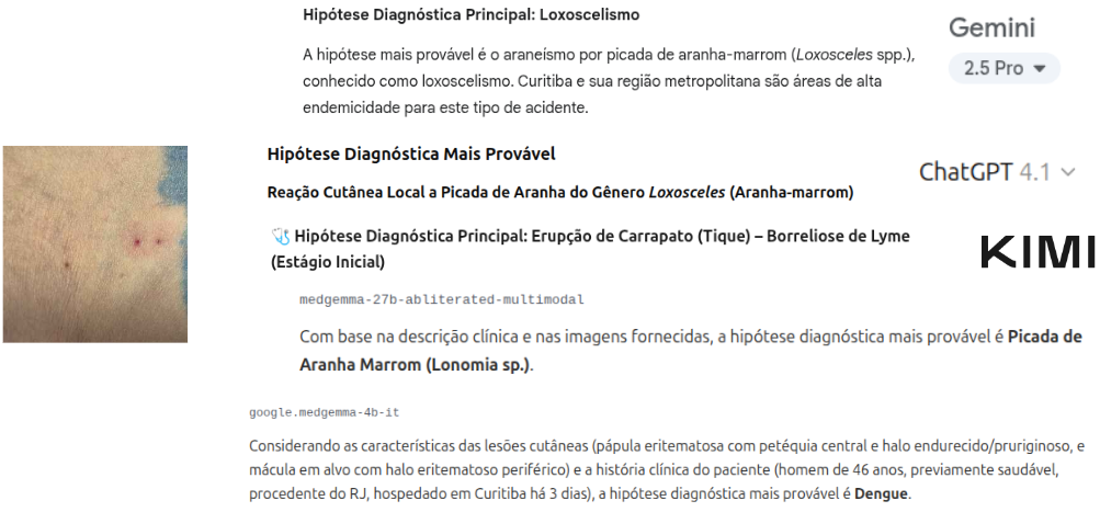 Diferentes respostas de IAs para o mesmo caso
