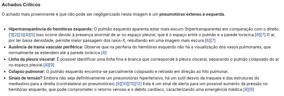 Imagem de Rx de tórax com pneumotórax